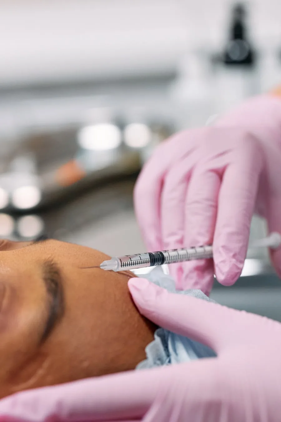 Aplicação de toxina botulínica